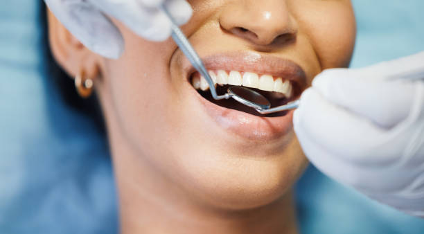 Best Dental Abscess Treatment in Cherryvale, SC